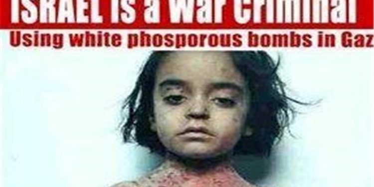 Sionist rejimin Qəzzədəki uşaq qətliamı