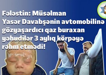 İsrail rejimindən 3 yaşlı körpəyə qarşı inanılmaz vəhşilik!