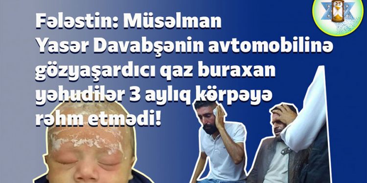 İsrail rejimindən 3 yaşlı körpəyə qarşı inanılmaz vəhşilik!