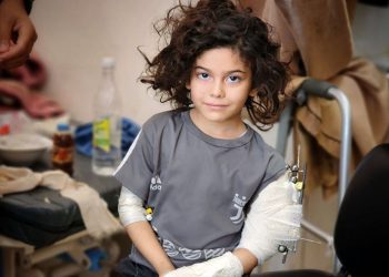 İşğalçıların Qəzzəyə olan hücumları nəticəsində fələstinli uşaqların daimi əlilliyi-Fotolar