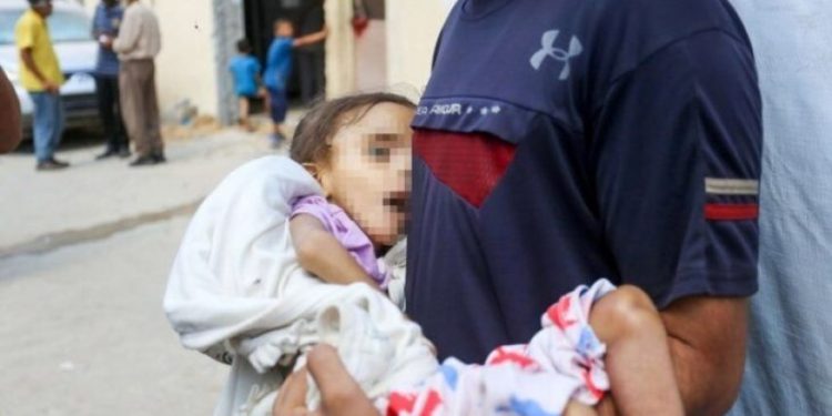 Fələstinli bir uşaq Qəzzədə aclıqdan ölüb
