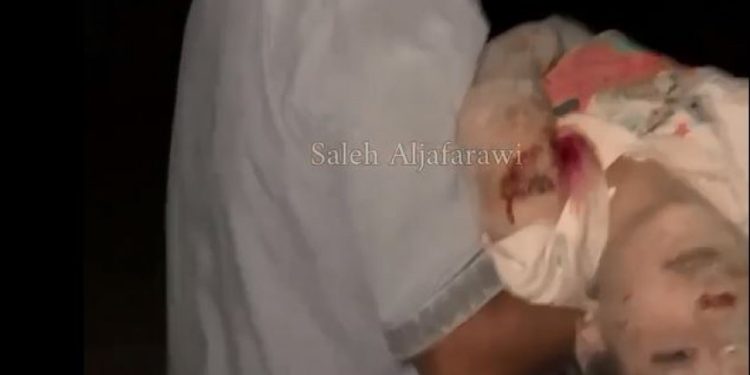 Deyr əl-Bələhdə fələstinli qaçqınların bombalanması