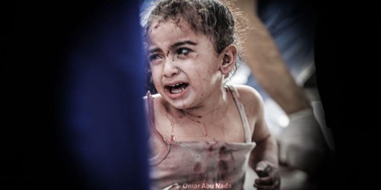 12 gün ərzində 900-dən çox fələstinli şəhid olub