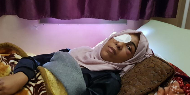 Qəzzədə 1500-ə yaxın insan görmə qabiliyyətini itirib