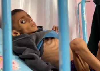 Mühasirə Qəzzada Mələkləri Yox Edir: Qidalanma Əskikliyindən 66 Uşaq Şəhid Oldu