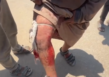 “Bu yardım deyil, bu qan içində ölümdür” – yaralı fələstinli ata danışır