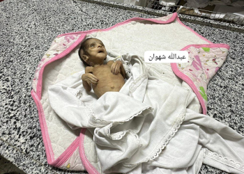 Aclıqdan öldürülürlər