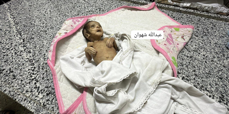 Aclıqdan öldürülürlər