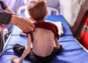 Qəzzədə uşaqlar sözün əsl mənasında aclıqdan ölürlər