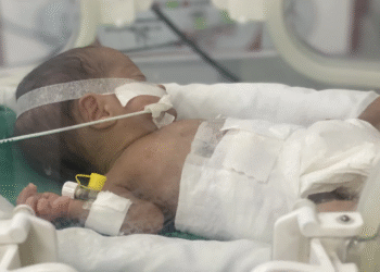 “Ən böyük fəlakət”: Qəzzada körpələrin həyatı yanacaq qıtlığı səbəbindən təhlükə altındadır