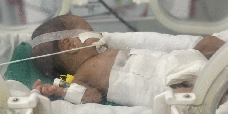 “Ən böyük fəlakət”: Qəzzada körpələrin həyatı yanacaq qıtlığı səbəbindən təhlükə altındadır