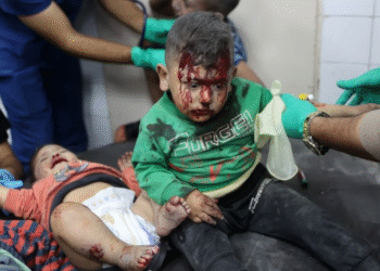 Böyük Britaniyanın xarici işlər naziri Lemmiyə Qəzzadan yaralı uşaqların təxliyəsi ilə bağlı verdiyi vədi yerinə yetirməsi üçün çağırış edilib