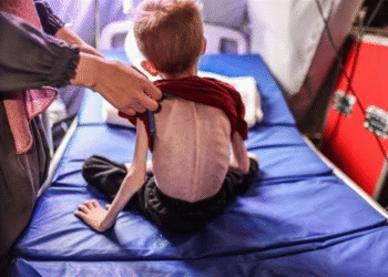 Qəzza müharibəsi – hər 10 uşaqdan 1-i qidalanma çatışmazlığından əziyyət çəkir