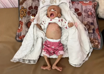 Qəzza zolağında 24 saat ərzində aclıqdan ikinci şəhid