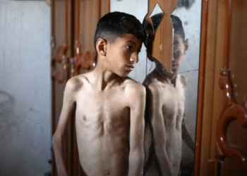 Qəzza aclıq təhlükəsinin astanasında – BMT: İsrail mülki əhalini aclıqdan öldürür